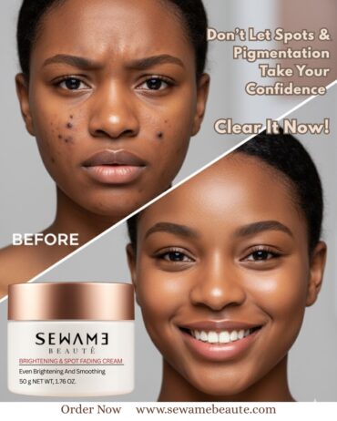 ig spot cream - SEWAME BEAUTE